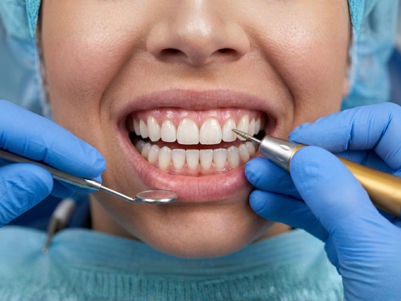 Cosmetic dentistry — veneer fitting and smile transformation